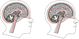 Brain Trans